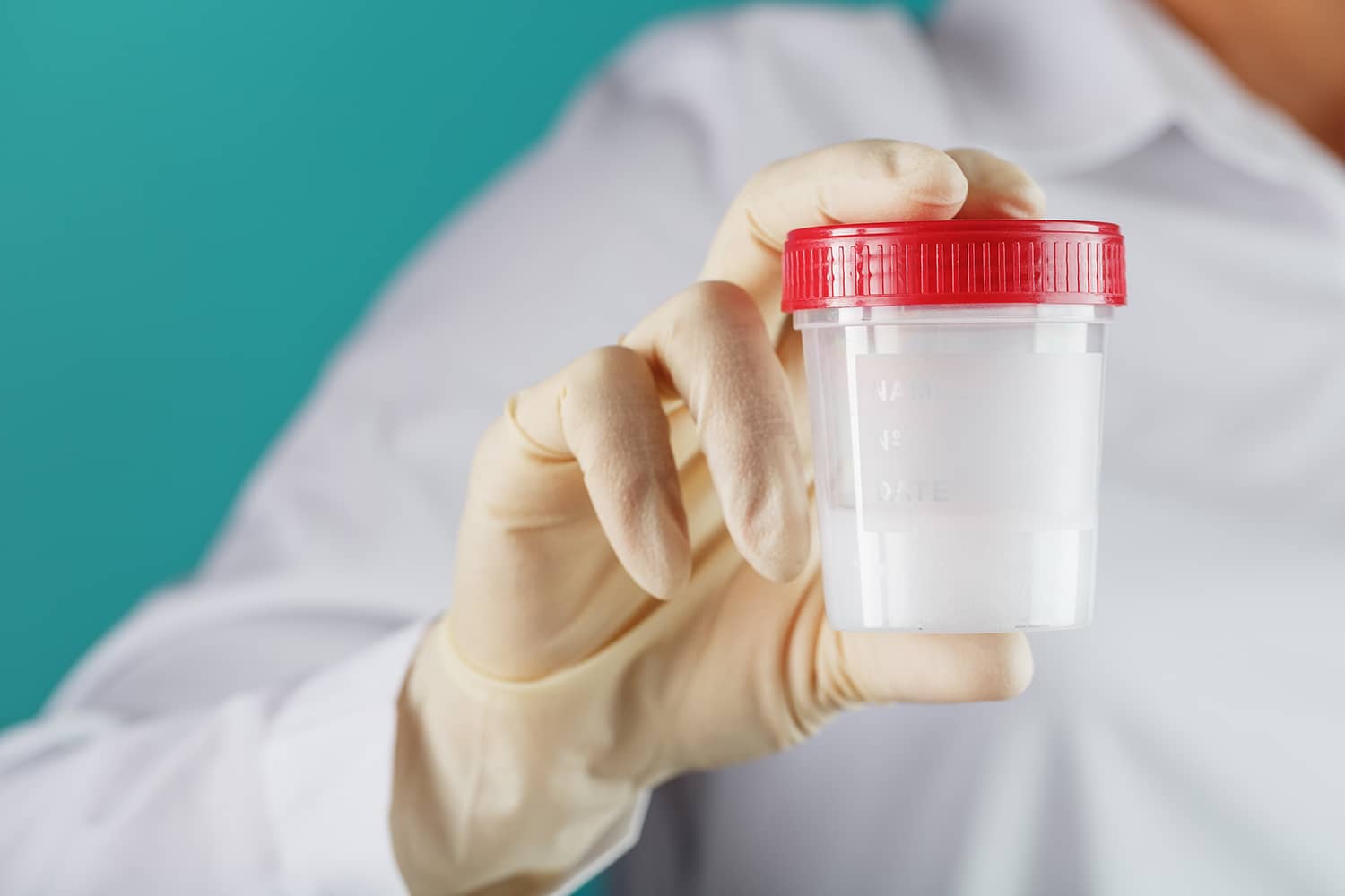 Oligospermia Oligospermia