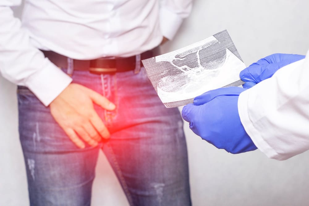 Síntomas De La Torsión Testicular Síntomas De La Torsión Testicular