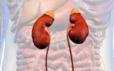 Pelvis Renal Dilatada: Comprensión Y Manejo