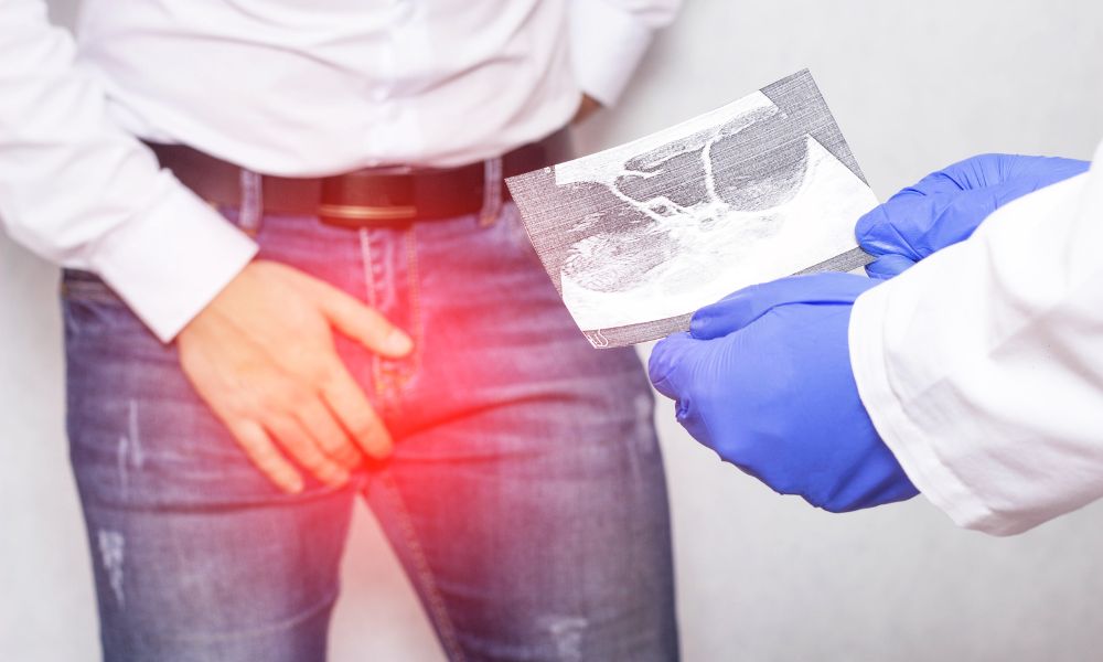 Problemas Comunes En La Salud Testicular Y Sus Tratamientos Problemas Comunes En La Salud Testicular Y Sus Tratamientos