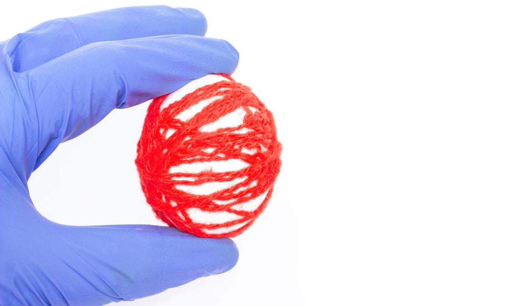 Varicocele E Hidrocele: Lo Que Debes Saber 1 Qué Es El Varicocele