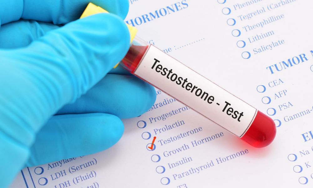 Testosterona Y Calvicie: ¿Cómo Están Relacionadas? 1 El Papel De La Testosterona En El Cuerpo Masculino