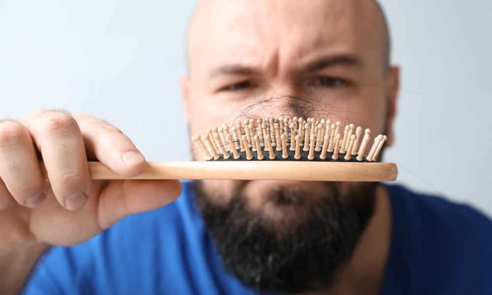 Testosterona Y Calvicie: ¿Cómo Están Relacionadas? 2 La Relación Entre La Testosterona Y La Caída Del Cabello