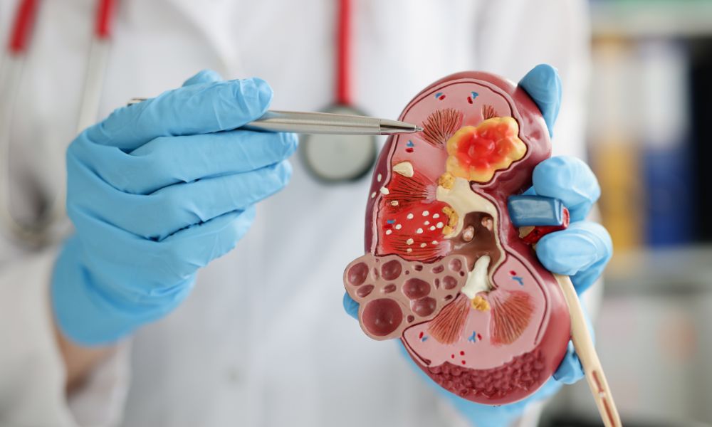 Síntomas De Infección En Los Riñones: Reconócelos 1 Síntomas De Infección En Los Riñones