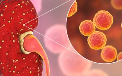 Síntomas De Infección En Los Riñones: Reconócelos