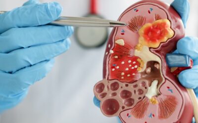 Uroflujometría: Guía Completa De Procedimiento