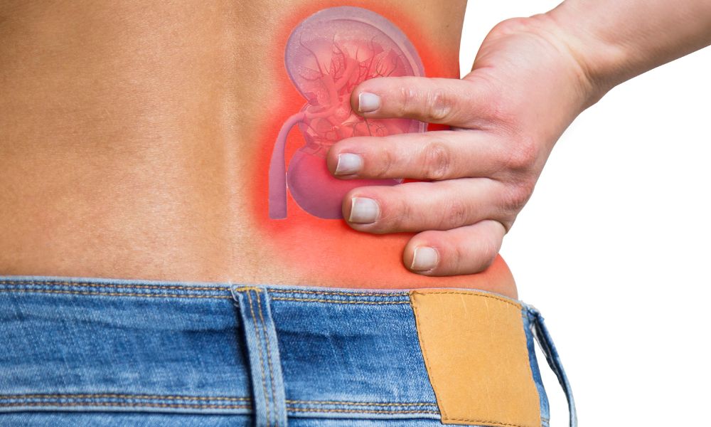 Cómo Prevenir Cálculos Renales Con La Dieta Adecuada 2 Estrategias Clave En La Cálculos Renales Dieta